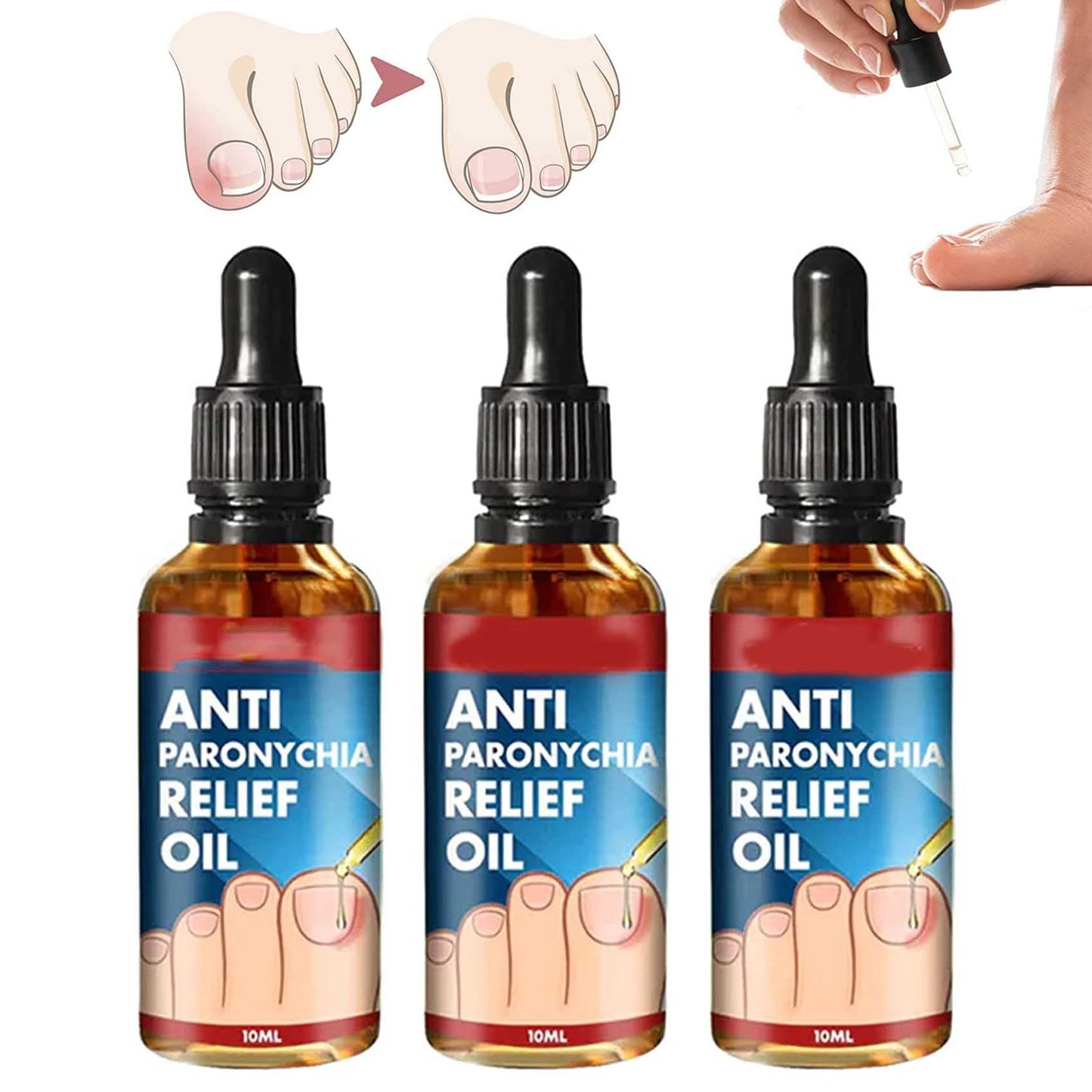 Tratamiento para Hongos en las uñas🌿