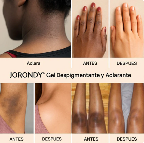 Gel Aclarador de Piel JORONDY