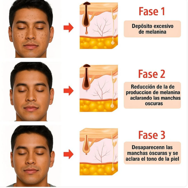 Gel Aclarador de Piel JORONDY