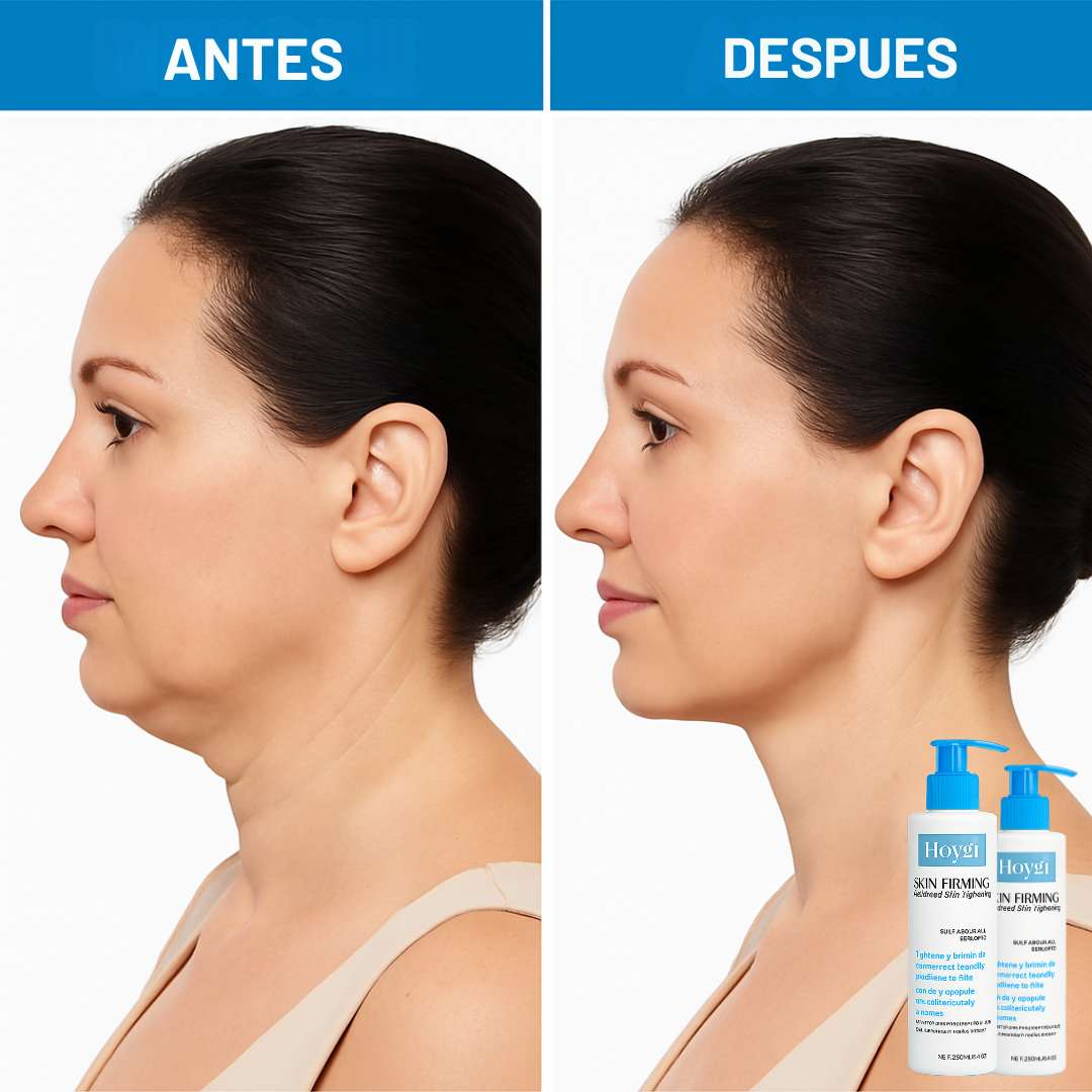 Crema Hoygi®|Cuello y Escote Rejuvenecidos